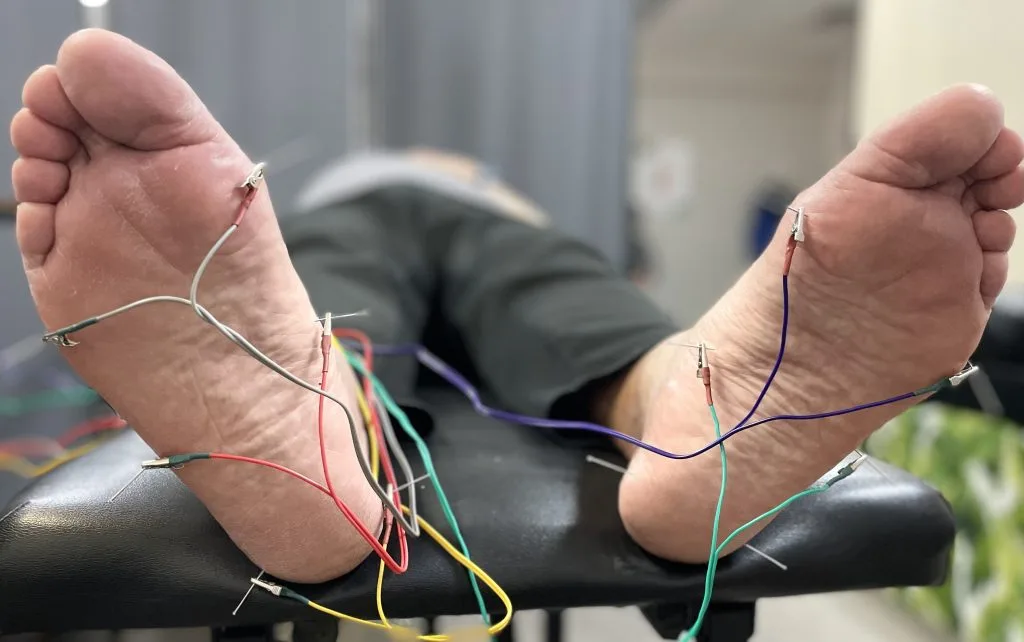 Dry Needling